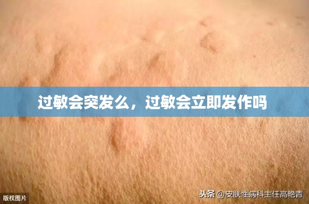 过敏会突发么,过敏会立即发作吗